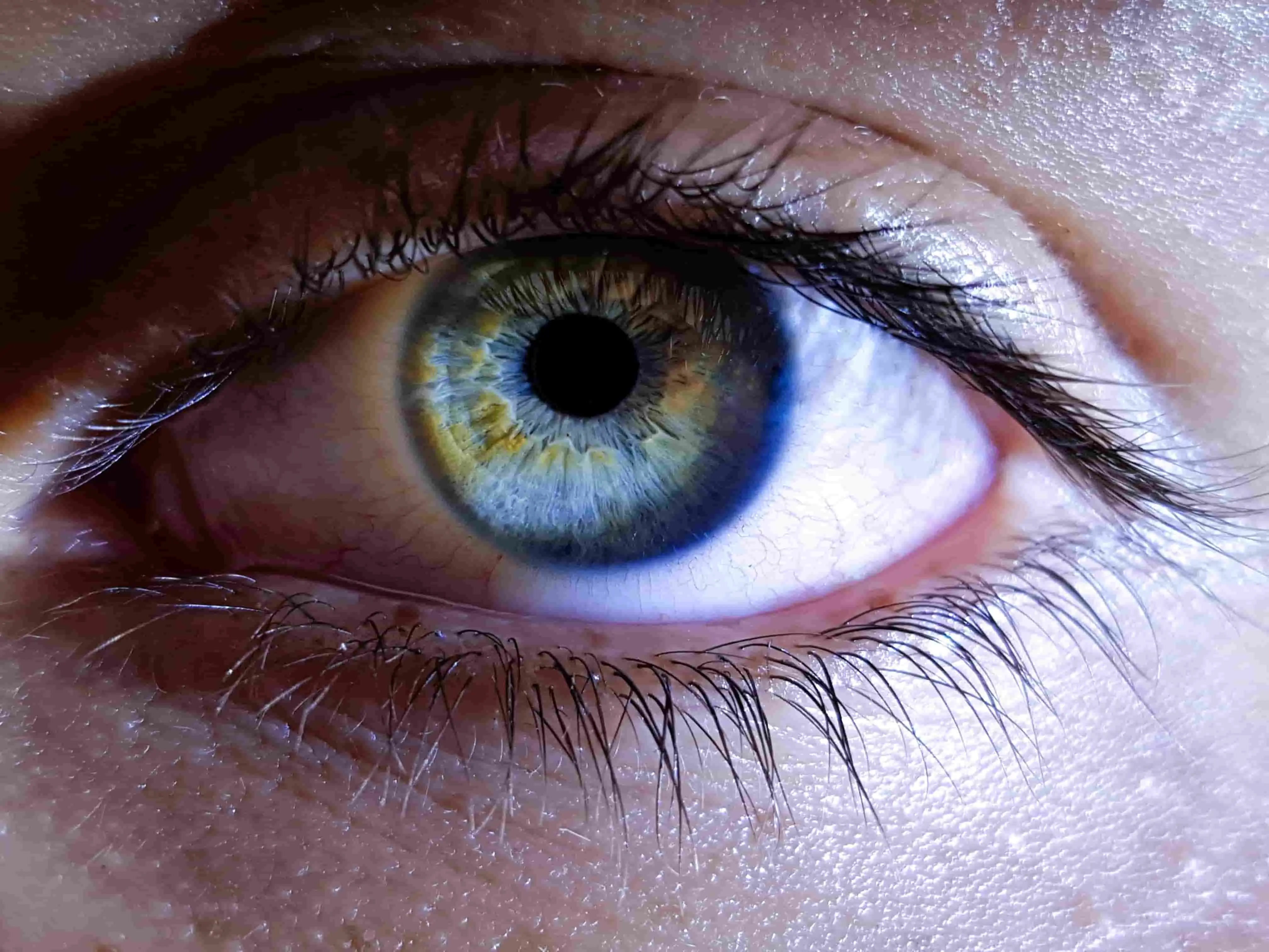 Glaucoma: Symptoms, Causes, Types, Diagnosis & Treatment featured image