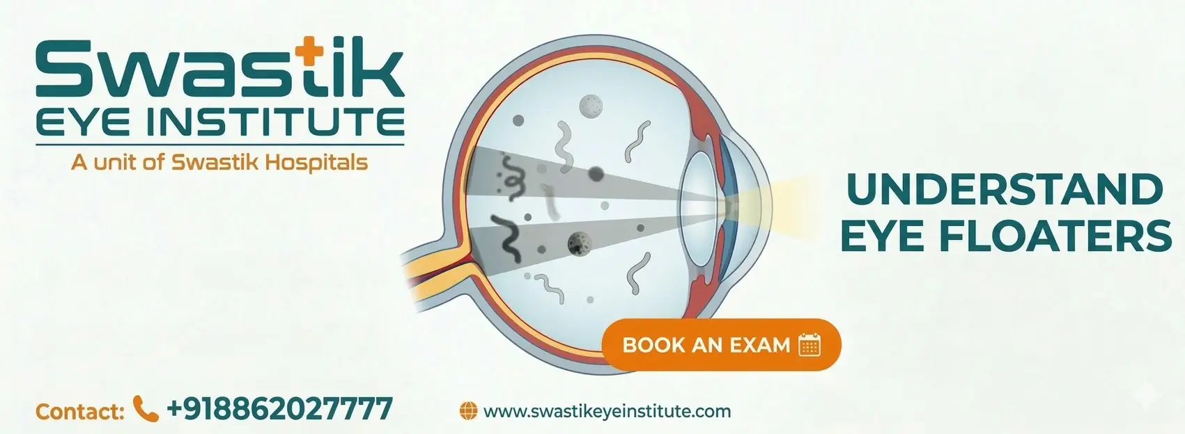 Eye Floaters: Causes, Symptoms, and Treatment