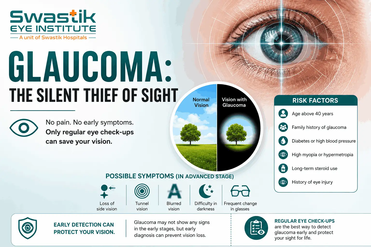 Glaucoma: The Silent Thief of Sight